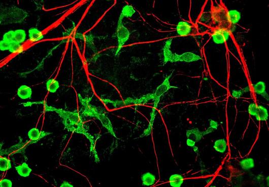 microglia