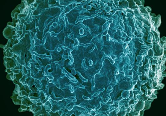 Magnified image of a spherical cell with many protrusions on its surface, colored blue-green