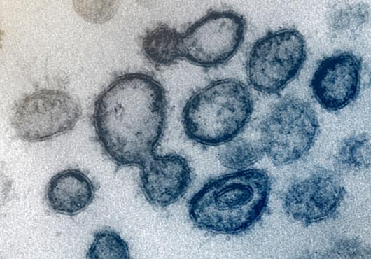 Microscope image of virus particles in blue against a pale background