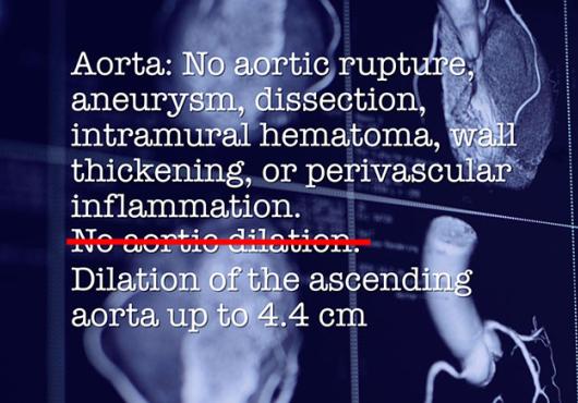 Text over angled view of CT scans of the heart
