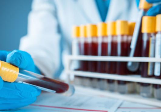 Image of blue-gloved hand holding a test tube full of blood 