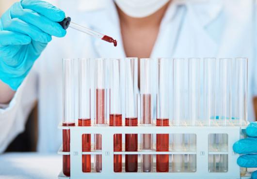 Photo of a person in a lab coat holding an eye dropper of blood over some glass vials 