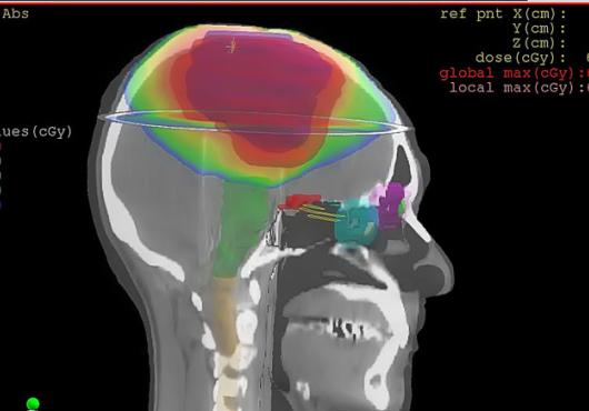 MRI-type of image of brain scan, profile view 
