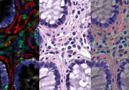 Three side-by-side images of the same starlike arrangement of cells, each in different colors