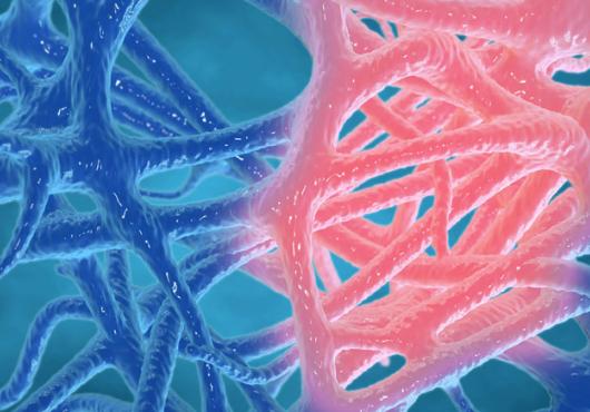 Illustration of inflammation, with some nerve endings pink, the rest blue