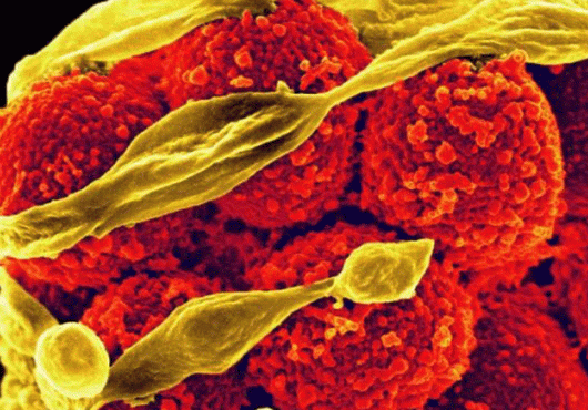 Staphylococcus aureus bacteria that have developed resistance to the antibiotic methicillin. Image: NIAID