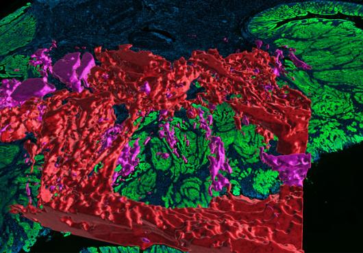 3D red and pink patches on top of a 2D green and blue area