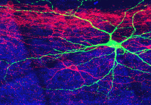 Patches of bright pink, purple, and green representing different types of neurons