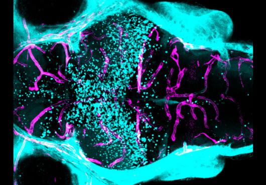 A blue, black, and pink image of a zebrafish brain