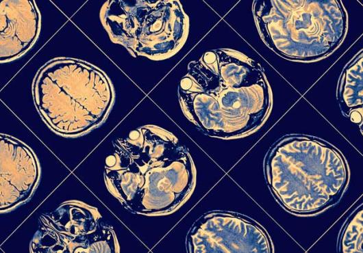 Image of brain scans