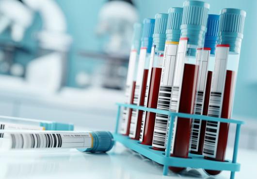 A rack of tubes containing blood samples, with two empty tubes lying down