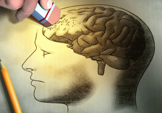 A drawing of a brain inside a human head, with the front portion of the brain being erased