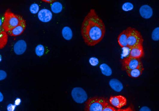 Human beta cells and insulin granules 