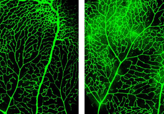 A pair of microscope photos showing blood vessels in the blood-retina barrier dyed green with fluorescent dye