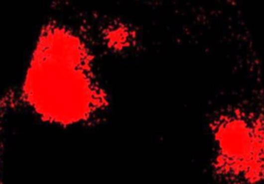 Irregular red patches representing dopamine on a black background that is the brain
