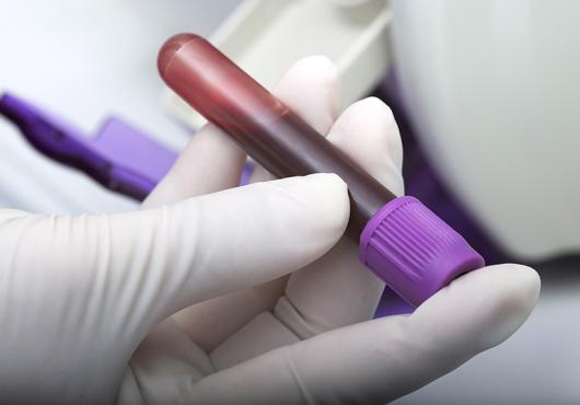 blood test