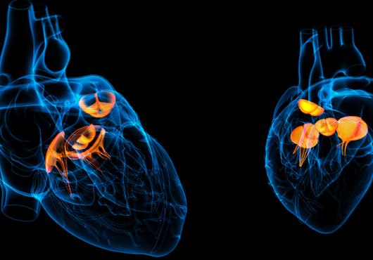 heart valves