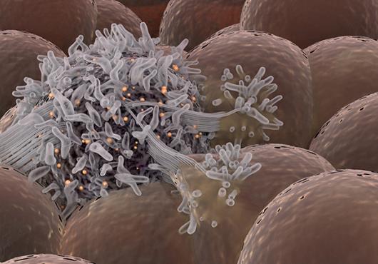 cancer cell