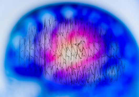 brain eeg