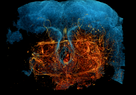 xnh brain