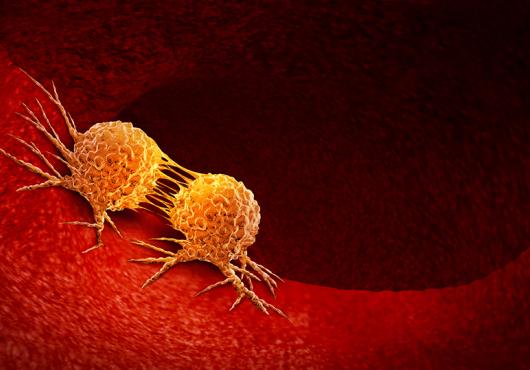 cancer cells