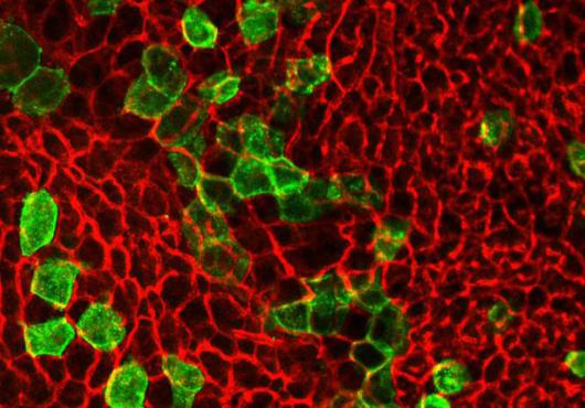 Photo of Brown adipocytes derived from progenitors expressing the Trpv1 receptor. 