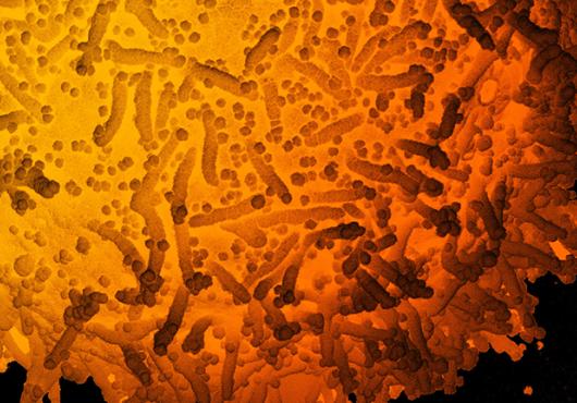 Colored electron micrograph shows a cell swarmed with small viral particles
