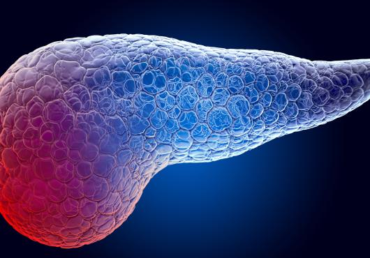 illustration of pancreas in blue and red; the red is meant to show pain