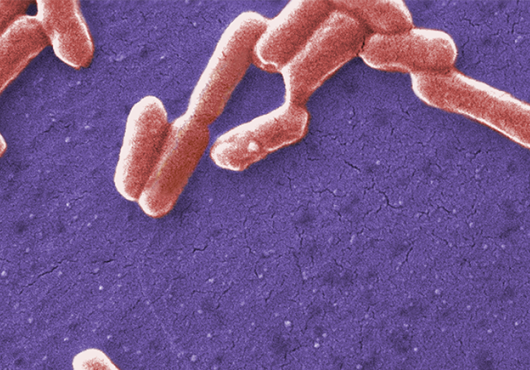 Micrograph with pill-shaped E. coli bacteria shown in pink against a purple background
