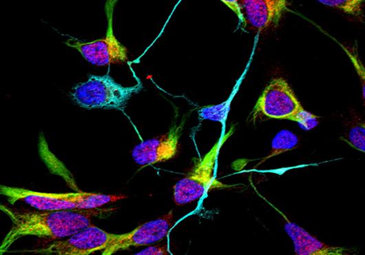 Neurons in blue and turquoise stand out against neurons in pink and green