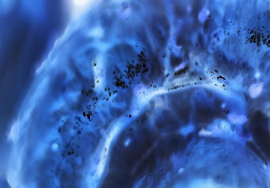 cancer cell close-up