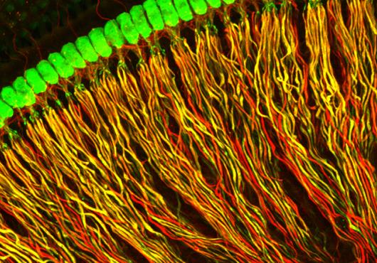 Spiral ganglion neurons