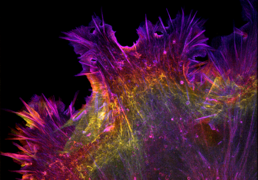 Spiky cell in pink, purple, orange and yellow