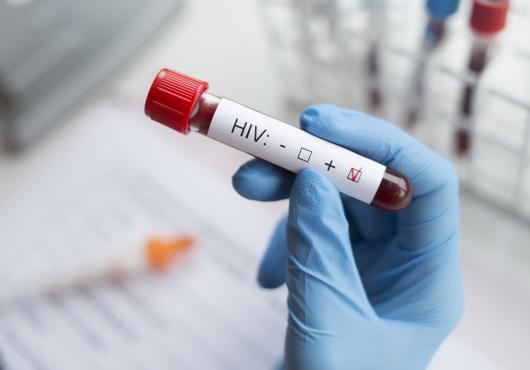 Photo of a gloved hand grasping a blood-test tube labeled "HIV+"; hand is wearing a blue medical glove; background is blurred blood-test tubes and notebook