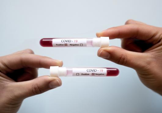 Two hands, each holding a covid-19 blood test, one negative, one positive