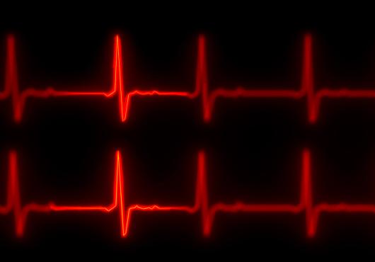 Two horizontal red lines punctuated with jagged peaks representing a heart beat on an electrocardiogram