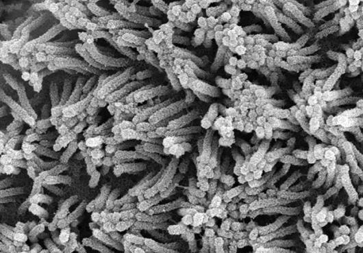 Black and white microscope image shows dozens or hundreds of tube-like projections aligned in different directions
