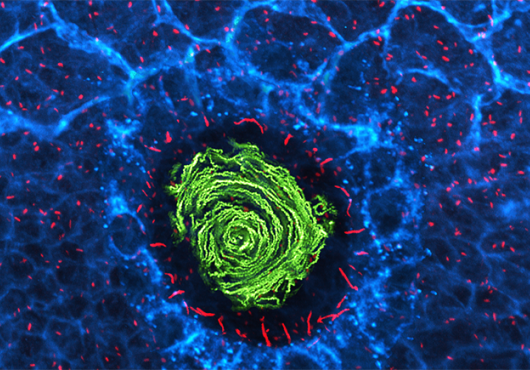 Microscopy image of cilia helping shape organ positioning during development