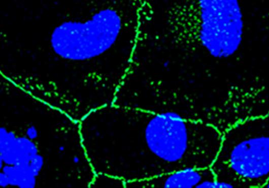 Confocal microscopy image of a whole mount of female mouse CE at 3 months post 500 J/cm2 UVA (green: ZO-1 staining (tight membrane junctions); blue: nuclear staining using DAPI)
