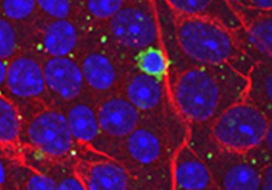 Elevated eye pressure can cause T cells, shown in green, to infiltrate the eye and attack neurons