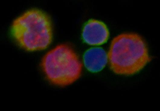 T cells glow blue, red and yellow