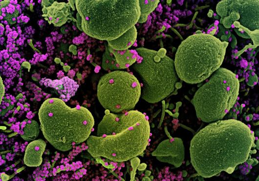 microscopic image of SARS-CoV-2