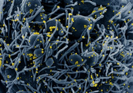 Electron microscopy image of SARS-CoV-2 tinted blue