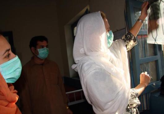 Three people in surgical masks examine an x-ray of a person's lungs.