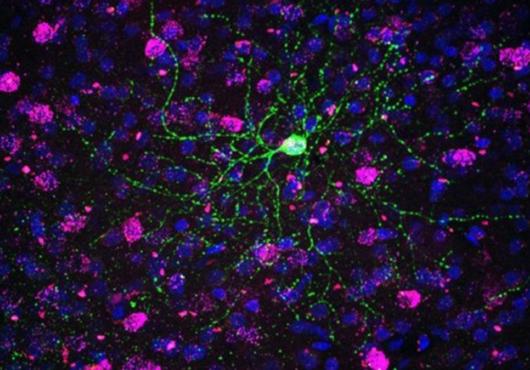Colorized micrograph shows web of green tendrils emanating from a nucleus against a backdrop of puple nuclei on black