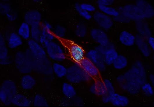 an elongated cell glows orange around the edges against a dark background in a fluorescently-tagged microscope image