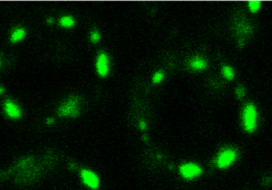 Fluorescent microscope image shows dotted green rings against a black backdrop