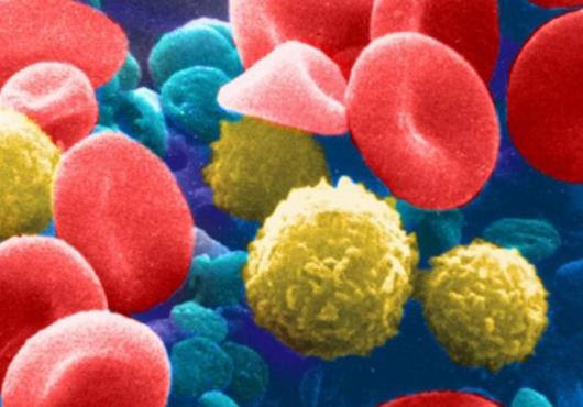 Micrograph of disc-shaped red blood cells and ball-shaped white blood cells on colorized blue background