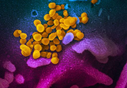 Scanning electron microscopy of new coronavirus