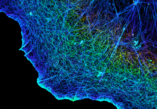 Fluorescent dye lights up actin strings in a cell in a rainbow of colors. The cell edge glows in a shape like a fried egg against a black backdrop.